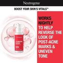 Stubborn Marks PM Treatment with Retinol SA, Face-Exfoliating Treatment to Help Reverse the Look of Post-Acne Marks & Uneven Skin Tone, Oil-Free, Non-Comedogenic, PM Treatment, Unscented, 1.0 Fl Oz