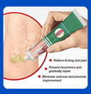 VascuRelief: Powerful Ointment for Varicose Veins and Spider Vein Pain Relief