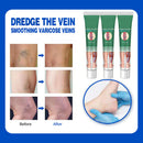 VascuRelief: Powerful Ointment for Varicose Veins and Spider Vein Pain Relief
