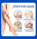VascuRelief: Powerful Ointment for Varicose Veins and Spider Vein Pain Relief