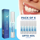 Flawless Instant Teeth Whitening Pen, Use Twice a Day for Visibly Whiter Teeth in 1 Week Effective & Painless Whitening, No Sensitivity, Easy to Use, Mint Flavor